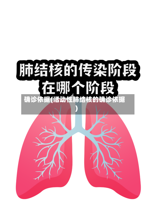 确诊依据(活动性肺结核的确诊依据)-第2张图片